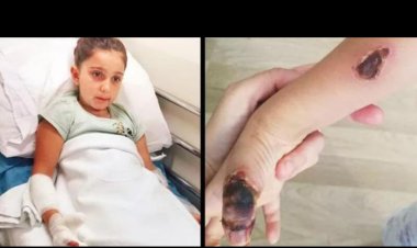 MR ÇEKİMİNDE KÜÇÜK KIZI YAKTILAR!