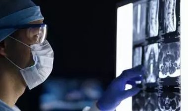 ALZHEİMER HASTALARINDA BEYİN HÜCRELERİNİN NEDEN ÖLDÜĞÜ KEŞFEDİLDİ